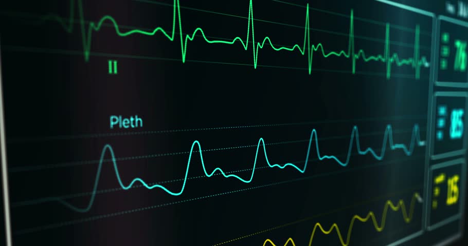 2025 loopable ECG animation showing cardiac heart rate monitoring in hospital, highlighting patient care, diagnostics, cardiovascular health, and medical technology.