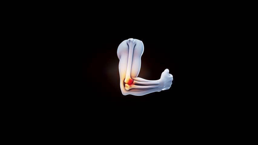 Conceptual 3D animation of a tennis elbow on fire