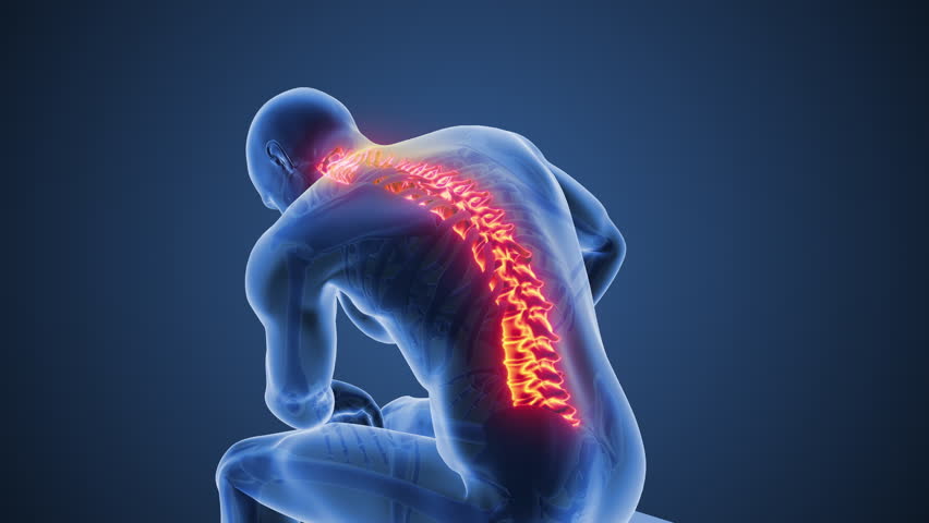 Medical Concept Showing Human Spine and Back Pain