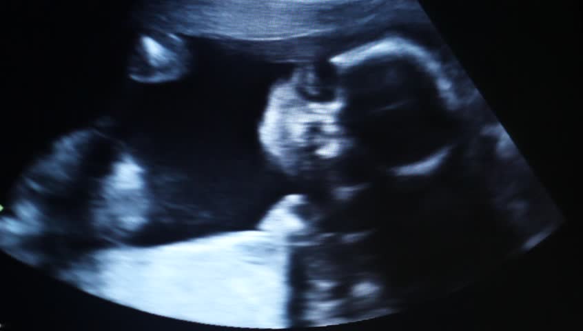 Ultrasound 5 Months Baby Stock Footage Video 100 Royalty Free Shutterstock