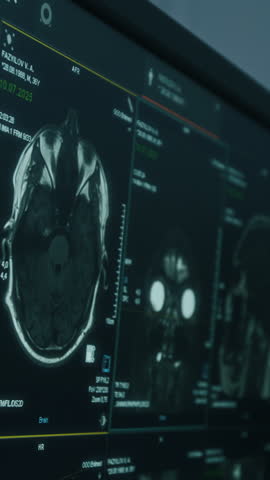 Vertical close-up view of digital screen displaying multiple MRI scans used by radiologists and neurologists to analyze brain structure and detect abnormalities