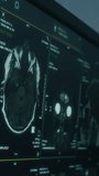 Vertical close-up view of digital screen displaying multiple MRI scans used by radiologists and neurologists to analyze brain structure and detect abnormalities - Powered by Shutterstock - Get 15% off with code: PIKWIZARD15
