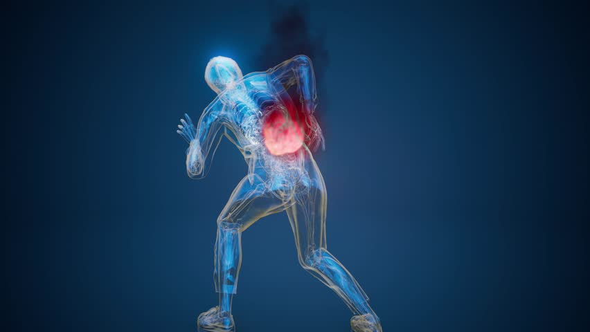 Conceptual 3D animation of a woman with back pain on fire