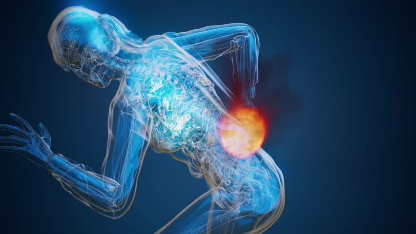 Conceptual 3D animation of a woman with back pain on fire