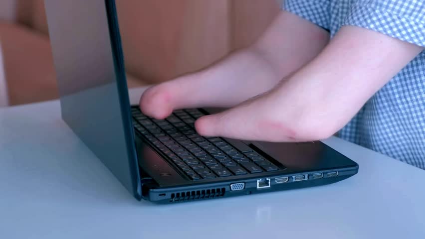 close up of someone typing on a laptop the person does not have complete fingers disabilities are working in the professional field