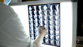 Orthopedic surgeon examining and explaining X-ray images on lightbox, pointing to bone structures during medical consultation in clinical setting.
 - Powered by Shutterstock - Get 15% off with code: PIKWIZARD15