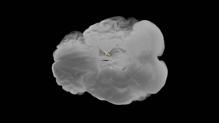 Basal ganglia–thalamocortical motor circuit with dopaminergic fibers from substantia nigra to motor cortex isolated on transparent background for educational overlay.