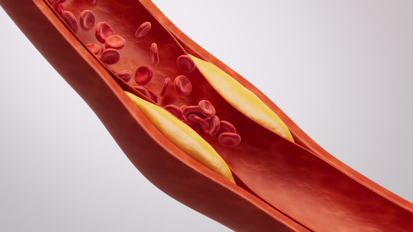 Blood vessel with blood fat in it, 3d rendering. Motion Graphic.