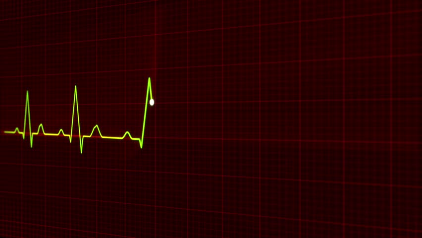ECG - Electrocardiogram Heart monitor -HD