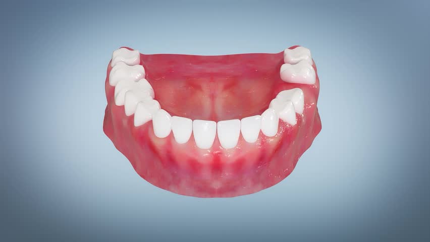 Dental implant surgical guide placement process, dental surgery, oral scan, model making, positioning, Dental implant and ceramic crown. Medically accurate tooth 3D Animation.