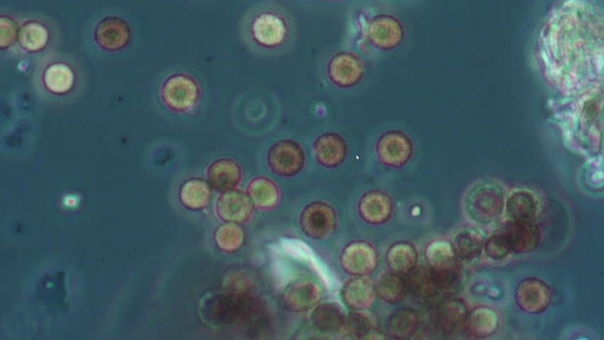 Round spores of the gib fungus when magnified under a dark-field microscope. The spores move in an aqueous solution and can cause allergies in humans.