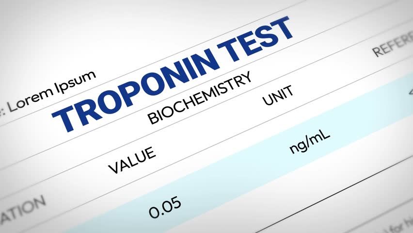 Troponin test mesauring protein 4k animation close up in blue typography. Health, medical, heart attack, muscle damage