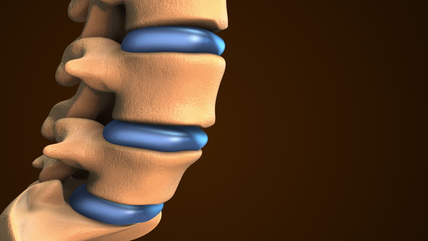Spinal Disc Herniation Shown in Medical Animation