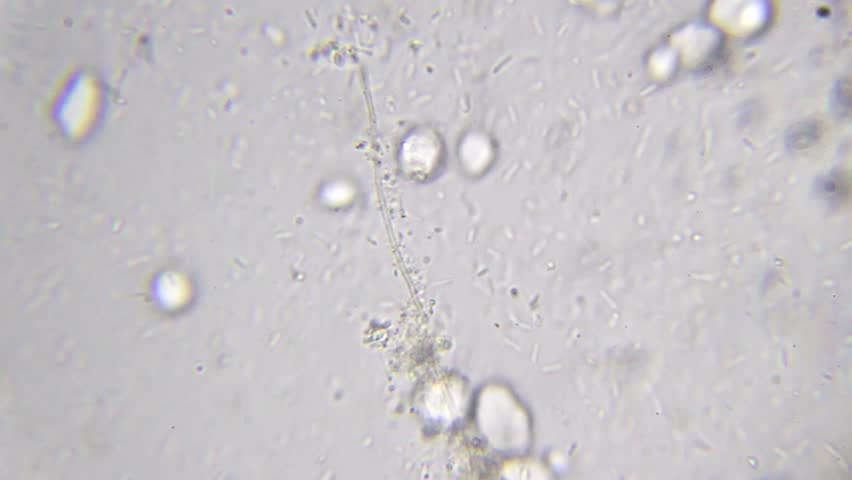 Bacteria colony and fungal hypha under a microscope at 2000x magnification with immersion oil