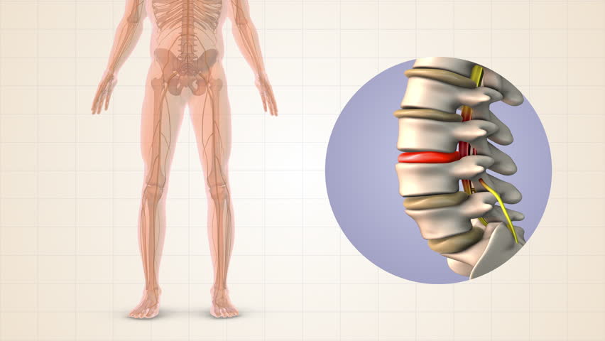 Sciatica Discomfort Travelling from Back to Legs