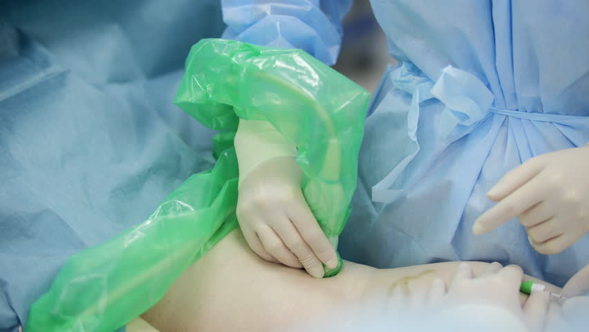 Ultrasound control during endovenous laser vein treatment