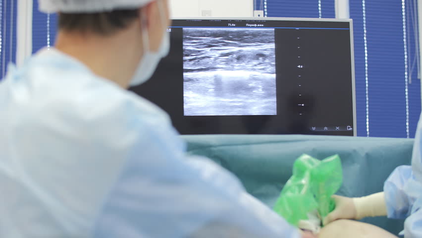 Doctor monitoring vein treatment with ultrasound guidance