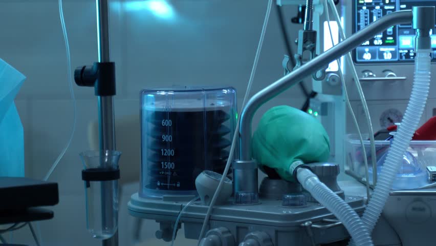 Advanced anesthesia machine with a mechanical ventilator providing artificial respiration and life support to a patient during surgery in a modern, dimly lit operating room at a hospital clinic
