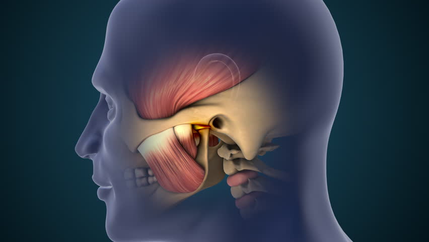 TMJ Disorder Causing Jaw Pain and Inflammation