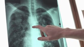 Doctor analyzing a human chest X-ray in 4K, highlighting medical diagnostics, radiology, healthcare, and patient examination. - Powered by Shutterstock - Get 15% off with code: PIKWIZARD15