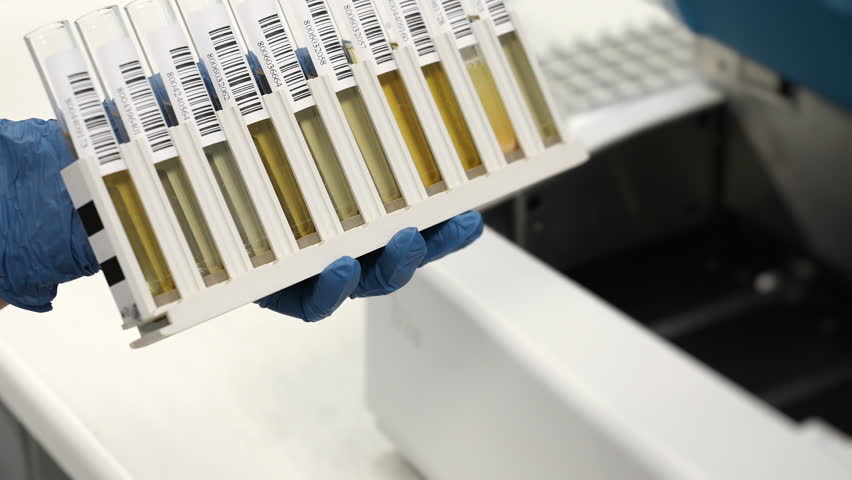 Close up of laboratory worker holding rack with barcoded test tubes, modern medical research and diagnostics in clinical lab under bright light. - Powered by Shutterstock - Get 15% off with code: PIKWIZARD15