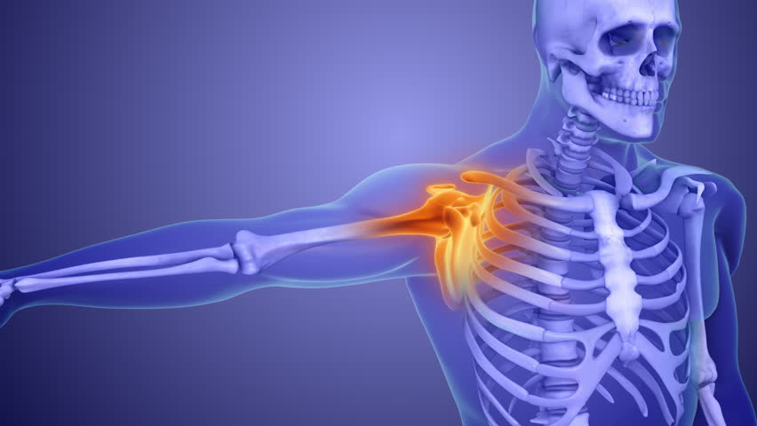 Shoulder Joint Pain Caused by Overuse Injury