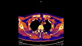 Detailed animation of colorful computed tomography (CT) scan slices. Visualization of a male human's anatomy for medical diagnosis or high-tech concepts - Powered by Shutterstock - Get 15% off with code: PIKWIZARD15