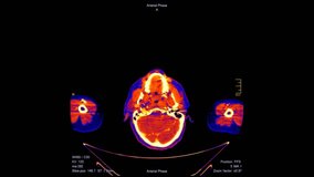 Detailed animation of colorful computed tomography (CT) scan slices. Visualization of a male human's anatomy for medical diagnosis or high-tech concepts - Powered by Shutterstock - Get 15% off with code: PIKWIZARD15