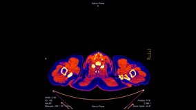 Detailed animation of colorful computed tomography (CT) scan slices. Visualization of a male human's anatomy for medical diagnosis or high-tech concepts - Powered by Shutterstock - Get 15% off with code: PIKWIZARD15