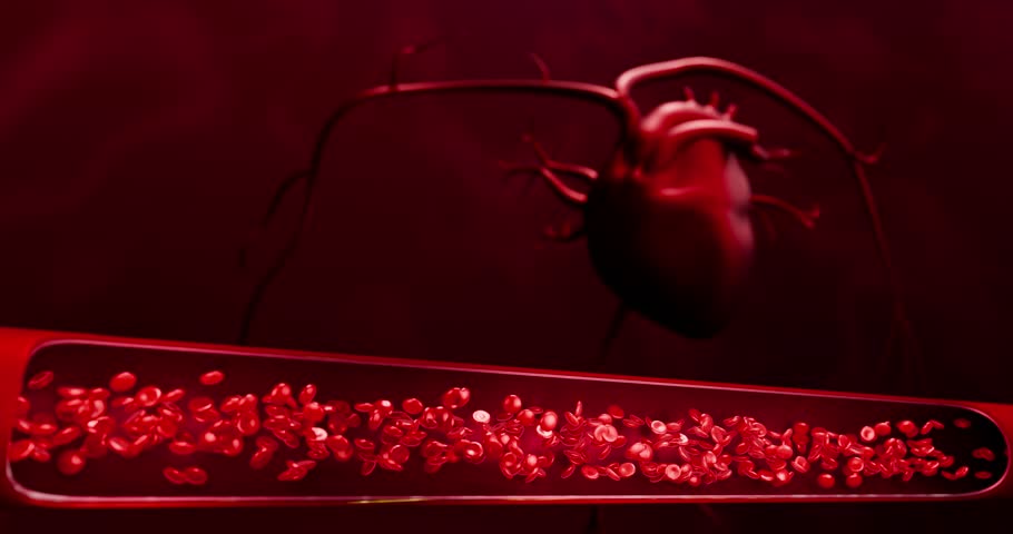 Concept of fast food, sugar, and alcohol leading to atherosclerosis, LDL cholesterol buildup, clogged arteries, cardiovascular disease, stroke, fatal heart attacks in the human body . 3D rendering.
