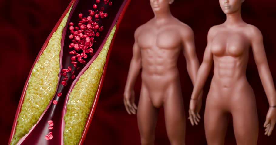Health Concept of Obesity and Cardiovascular Risk from Visceral and Subcutaneous Fat Accumulation 3D Rendering

