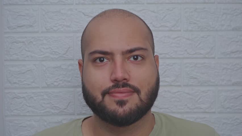 Man Applying Caffine Solution Under the Eyes