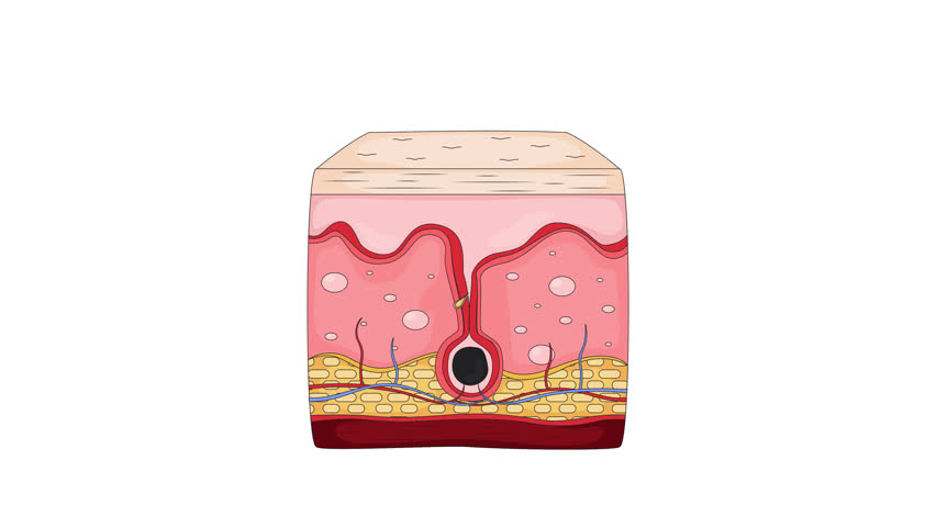 Human skin cross-section with hair follicle growing anatomy cartoon animation. Epidermis dermis and sebaceous gland. Subcutaneous layers animated flat 2D object 4K video isolated on white