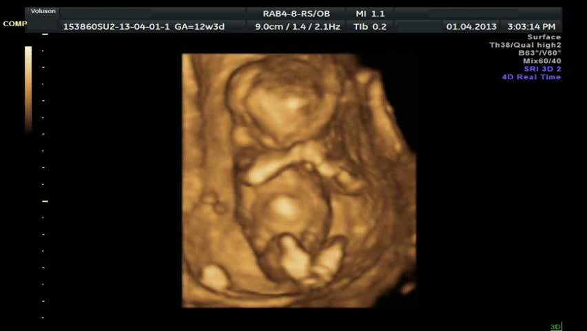 4d ultrasound video