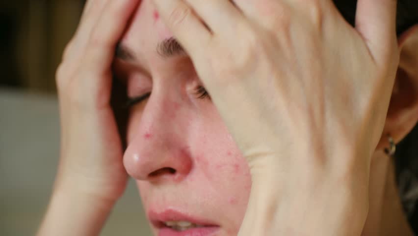 close-up white woman acne-prone cheeks touching, bathroom light, visible red pimples along jawline, fingers pressing skin, anxious expression, interrupted morning routine, candid emotional moment
