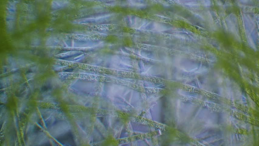 Filamentous green algae under microscope