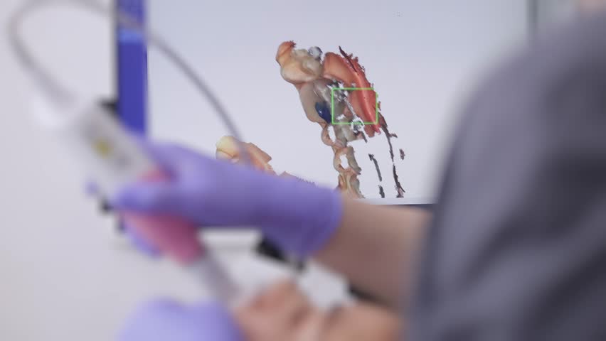 Dentist scanning patient's teeth with braces intraoral 3D scanner in modern clinic.