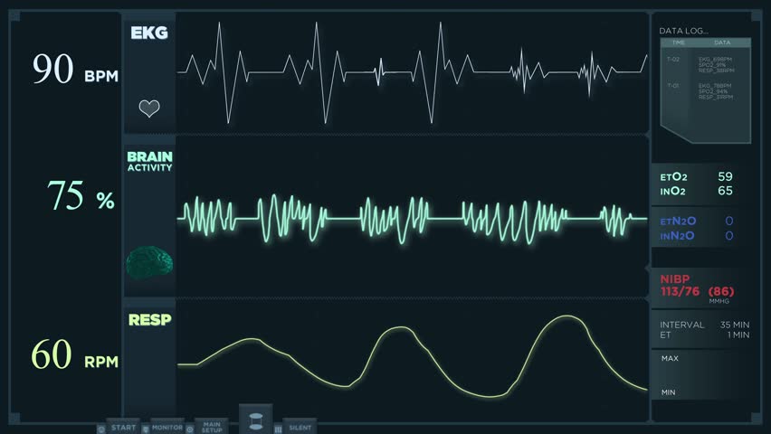 Medical Monitor Displaying Vital Signs 4k