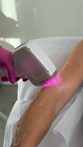Woman in safety glasses gets laser hair removal treatment on arm in modern beauty clinic. Aesthetic procedure using diode laser and cooling gel.