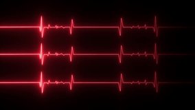  An electrocardiogram (ECG or EKG) waveform is a visual representation of the electrical activity of the heart. It is a common symbol for a heartbeat or pulse monitor signal.  - Powered by Shutterstock - Get 15% off with code: PIKWIZARD15