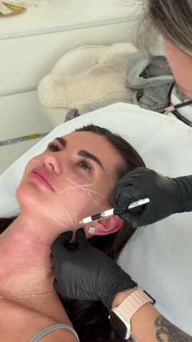 Aesthetician marks facial lines with white pencil before thread lifting procedure on young woman face.