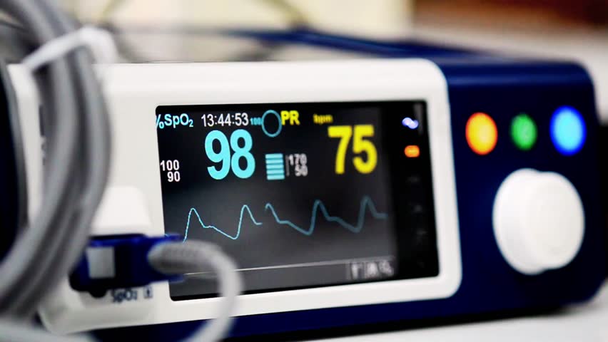 Close-up of a pulse trace monitor displaying heart rate and pulse waveform, highlighting cardiovascular monitoring and patient vital signs in real time.
