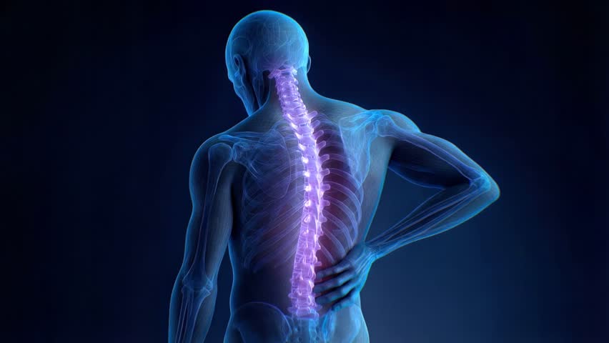 Medical animation showing a man suffering from back pain with a highlighted spinal column