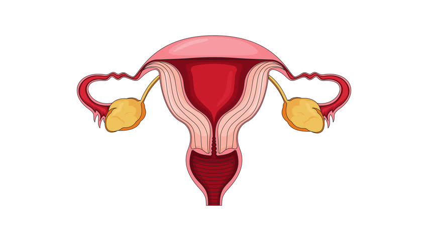 Late-stage ovarian cancer in female reproductive system cartoon animation. Oncology. Gynecological disease. Tumor clusters of ovary growing animated flat 2D object 4K video isolated on white