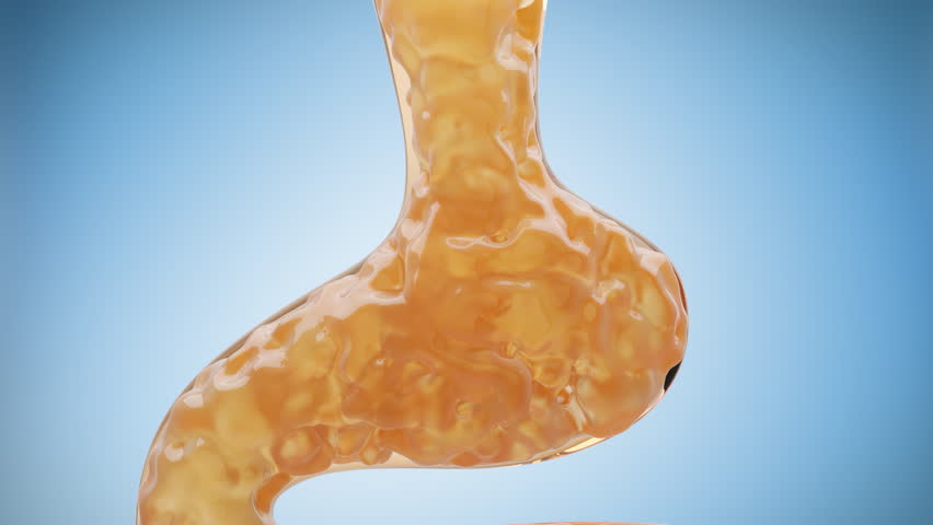 Medical concepts on human anatomy to reduce intestinal obstruction from fat through detoxification and good bacteria.
