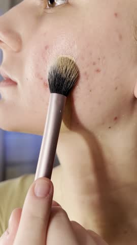 Girl applying foundation with a makeup brush, covering blemish-prone skin. Close-up skincare and beauty routine showing imperfect skin and natural coverage.
