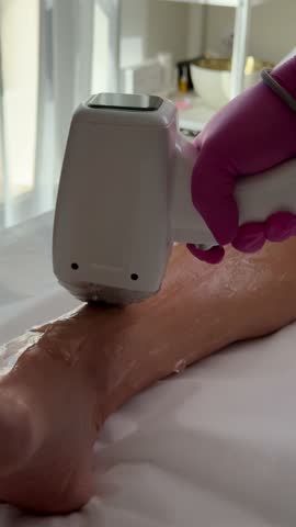 Aesthetician performs laser hair removal on a woman leg using a gel and handheld laser device. Close-up of the professional procedure