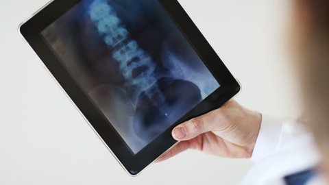 professional doctor working with x-ray scan on tablet pc
