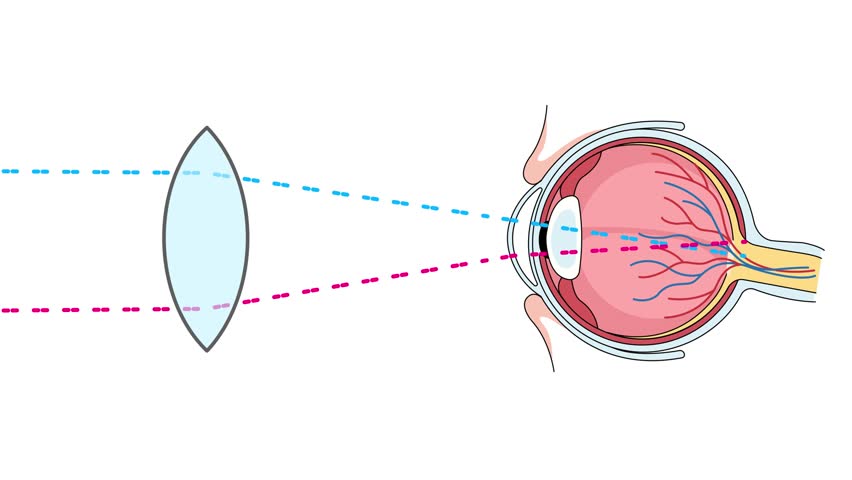 convex lens eye focusing light on retina accommodation vision science animation	