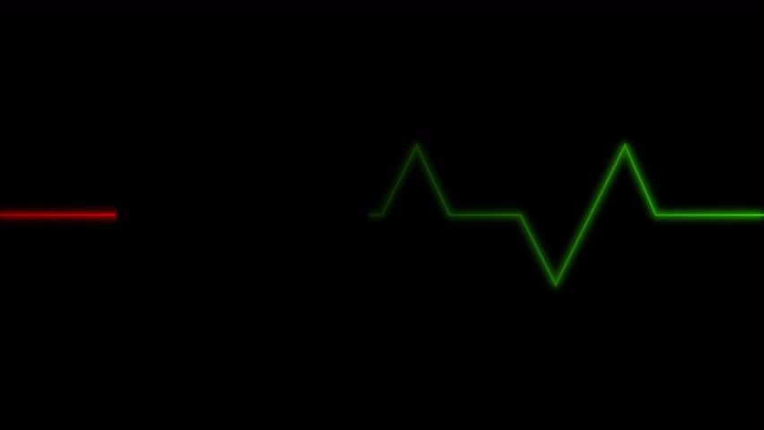 Vibrant green medical waveform signifying active vital signs contrasted with a flat red line indicating a lack of activity.